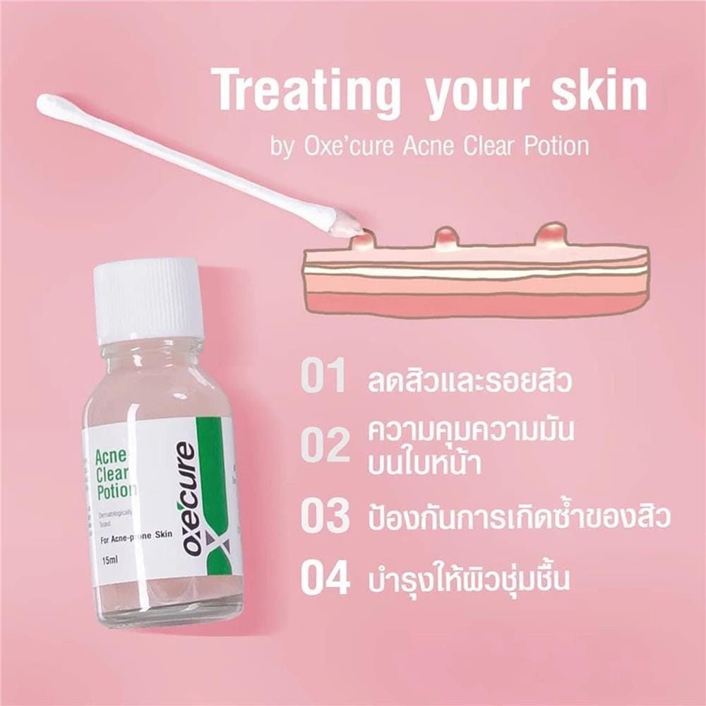โพชั่น แป้งน้ำชมพูลดสิว OXECURE ACNE CLEAR POTION (10OX00096) 15 มล.