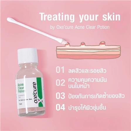 โพชั่น แป้งน้ำชมพูลดสิว OXECURE ACNE CLEAR POTION (10OX00096) 15 มล._1